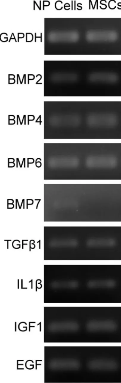 Figure 1. Expression Profiles of Cytokines in NP cells (left column) and MSCs (right column).