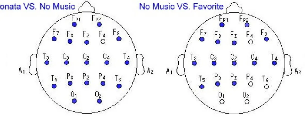 圖  十八    Gamma  波中聆聽不同音樂時各導程之統計差異圖 