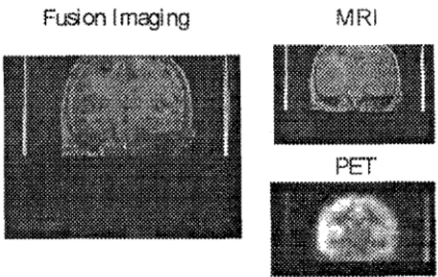 Fig. 2 Imaging Transformation 