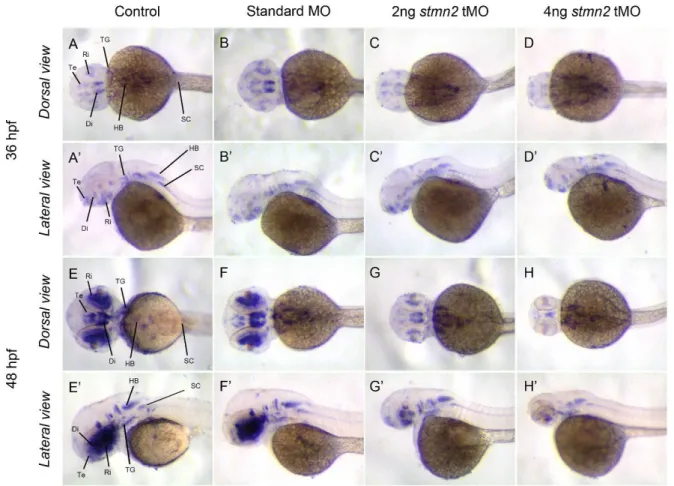 Fig. 7. Knockdown of stmn2a inhibits islet1 expression. 1-cell stage embryos were injected without (control) or with  indicated MO, fixed at designated time, subjected to whole-mount in situ hybridization and photographed at the dorsal and  lateral views