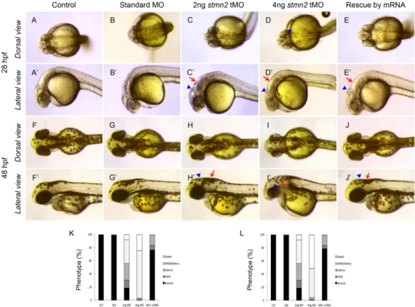 Fig. 6. Knockdown of stmn2a impairs brain development. 1-cell stage embryos were injected without (control) or with  indicated MO and stmn2 mRNA, cultured to the designated time and photographed at the dorsal and lateral views