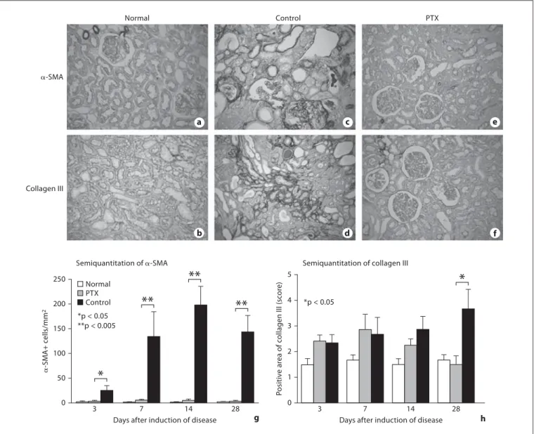 Fig. 2.   Effect of PTX treatment on accumulation of   ␣ -SMA+  myo- myo-fibroblasts and collagen III in a rat model of crescentic  glomeru-lonephritis at day 28