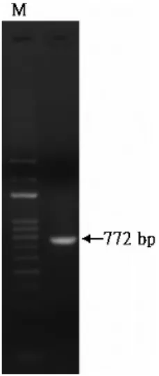 Figure 1 Agarose gel showing RT-PCR products of extra small virus extracted from post-larvae of white tail disease-infected prawn