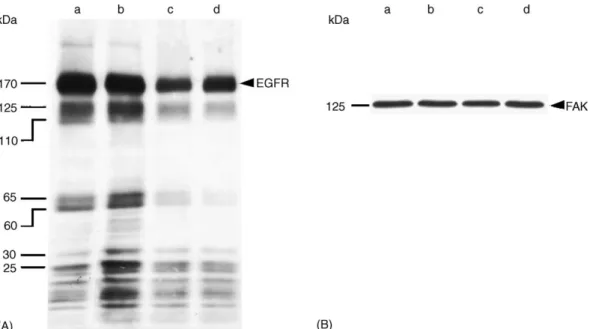 Fig. 4. In vitro effect of Qu and Lu upon the tyrosine kinase activity of MiaPaCa-2 cellular proteins