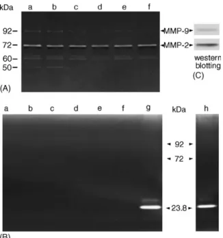 Fig. 5. Effects of Qu, Lu and EGF on the secretion of MMPs in MiaPaCa-2 cells. Cells at 50% confluence were treated with 20 mM Qu or Lu, and/or 10 nM EGF in serum free medium for 24 h