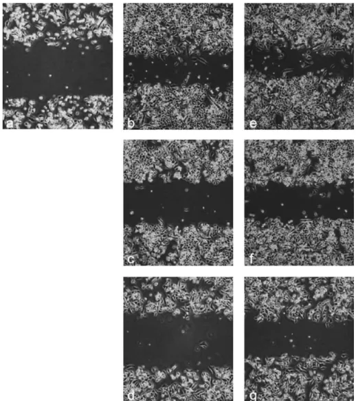 Fig. 7. Effect of Qu, Lu and EGF on wound healing of MiaPaCa-2 cells. MiaPaCa-2 cells (2  10 5 ) were plated onto 6-wells and allowed to grow in the presence of 10% fetal bovine serum