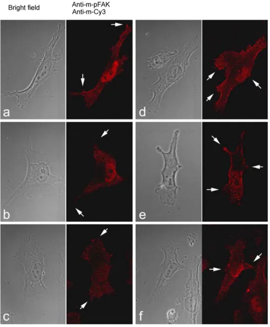 Fig. 9. Effect of Qu, Lu and EGF on phosphotyrosyl-FAK localization in MiaPaCa-2 cells