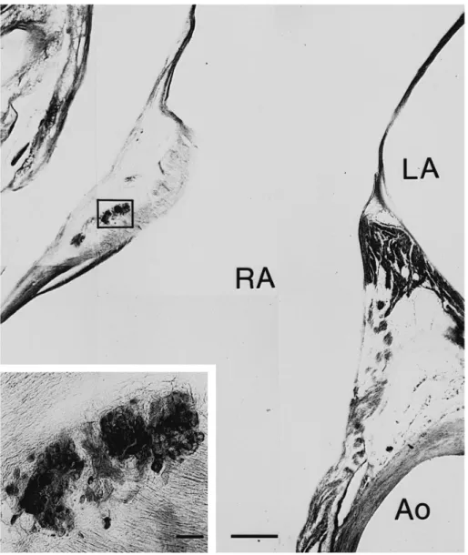 Fig. 3. Photomicrographs of intracardiac ganglionic neurons in the heart, stained with acetylcholinesterase histochemistry