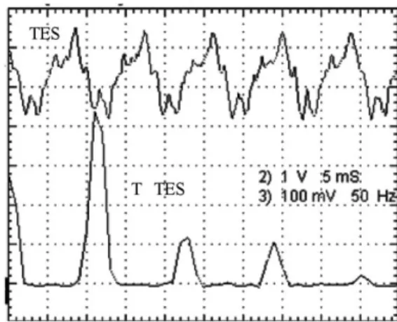 Fig. 14. The magnitude of T a ðsÞ for disk running at CAV 75 Hz without the FACT.