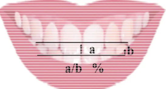 圖 3 .   微笑弧線比率與門牙傾斜度關係圖。 