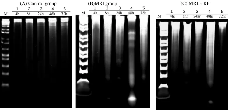 Fig 3: DNA fragmentation detected in human chondrocytes after exposing 3T magnetic field (MRI) and 3T magnetic field plus radio frequency (MRI + RF) one hour.
