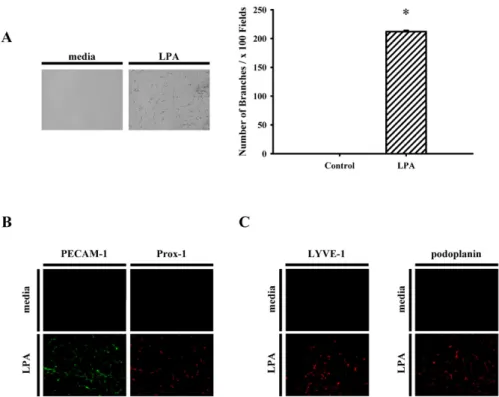 Figure 4. LPA stimulates endothelial cell tube formation and specific lymphatic markers expression in vivo