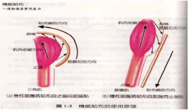 圖 2 - 2 - 2 機 內 效 貼 布 貼 紮 方 式 之 原 理 ( 引 用 自 : 駱 明 瑤 , 2 0 0 8 )  