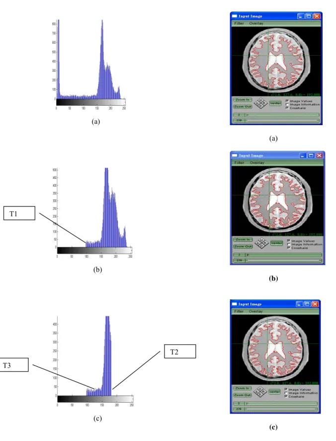 Fig. 4. (a) is the histogram of the smoothed image and (b) (c)  are the modified histograms
