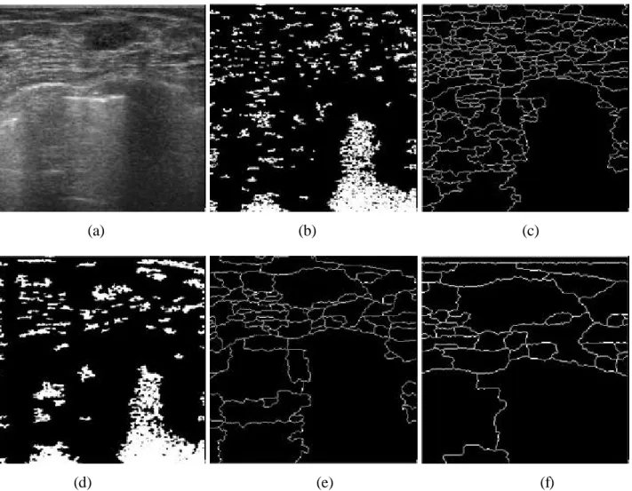 Fig. 6.  Watershed segmentation with the distinct preprocessing: (a) the original ultrasound image, (b)  the  markers generated without preprocessing, (c)  watersheds  generated  without  preprocessing, (d) the marker generated by the ultrasound image thro