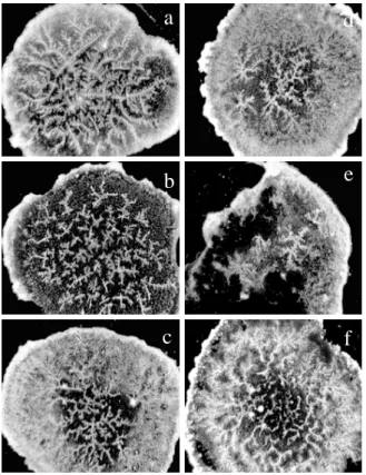 Fig. 6. Patterns formed for the anionic detergents on a cover glass  at 25 o C. In water, 0.1 ml, w = 1x10 -7  M, a S6S, b S8S, c S10S, d  S12S, e S16S, f S18S, length of the bar is 200  　m