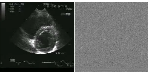 Figure 4: Sonogram test image  (a) Original test image 