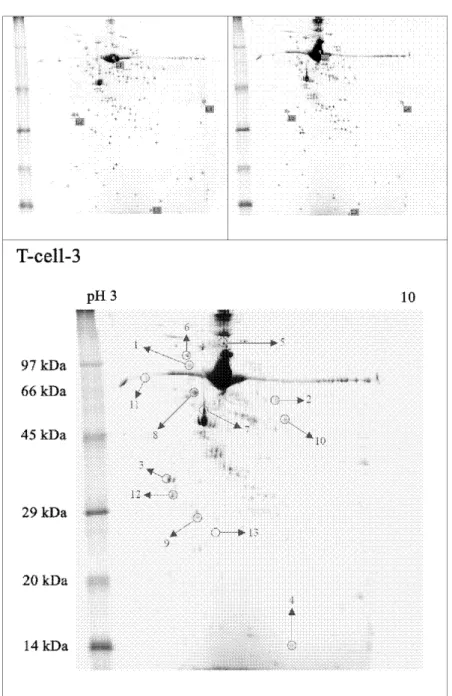 Figure 1. Representative 2D-PAGE gels of the CD4+ T-lymphocytes from uncontrolled asthma  patients (top left) to controlled level (top right)