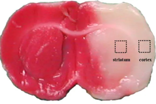Figure 4-2. Representative photograph showed the brain coronal section  located on the posterior bregma 0.92 mm position