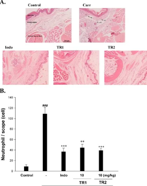 Figure 5. Representative light micrographs of mouse hind footpad H&amp;E stained (A) to reveal hemorrhage, edema, and inﬂammatory cell inﬁltration in control mice