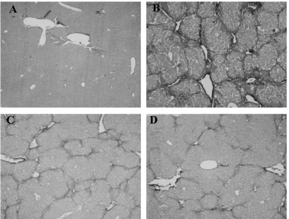 Fig. 8. Treatment with ABE improved the histology of CCl 4 -treated mice liver. Sirius Red staining of liver sections from: (A) control group; (B) CCl 4 + H 2 O group, showing micronodular formation and complete interconnection of septa with each other