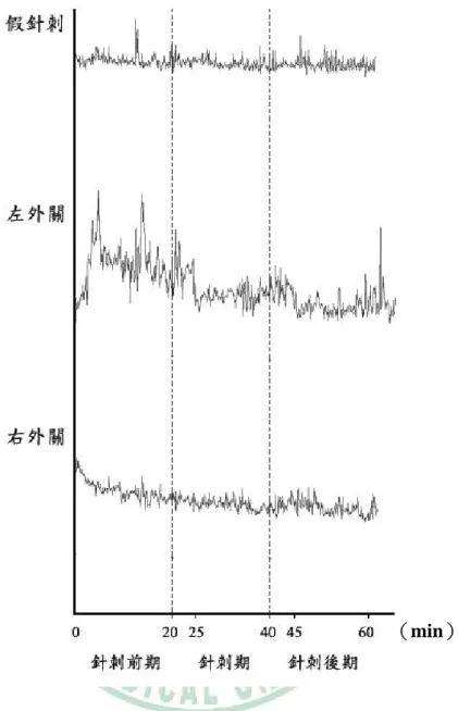 圖 4.1  三種針刺法於針刺各期對左手背中央部位皮膚血流之示意圖。左 手背中央部位皮膚血流在針刺左外關後開始減少，針刺後期更為 明顯。針刺右外關於針刺期、針刺後期和針刺前期左手背部中央 部位之血流變化不明顯。針刺前期：針刺前之皮膚血流紀錄；針 刺期：針刺期間之皮膚血流紀錄；針刺後期：取針後之皮膚血流 紀錄。  （min） 