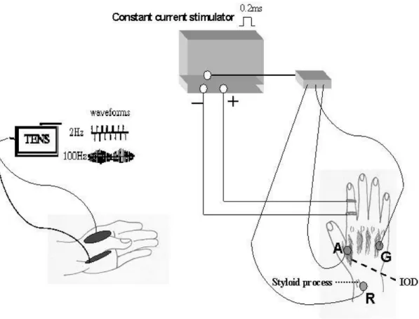 圖 3.5.  表皮反射的記錄與經皮電刺激的示意圖。  The positioning of  the stimulator ring  electrodes  was shown