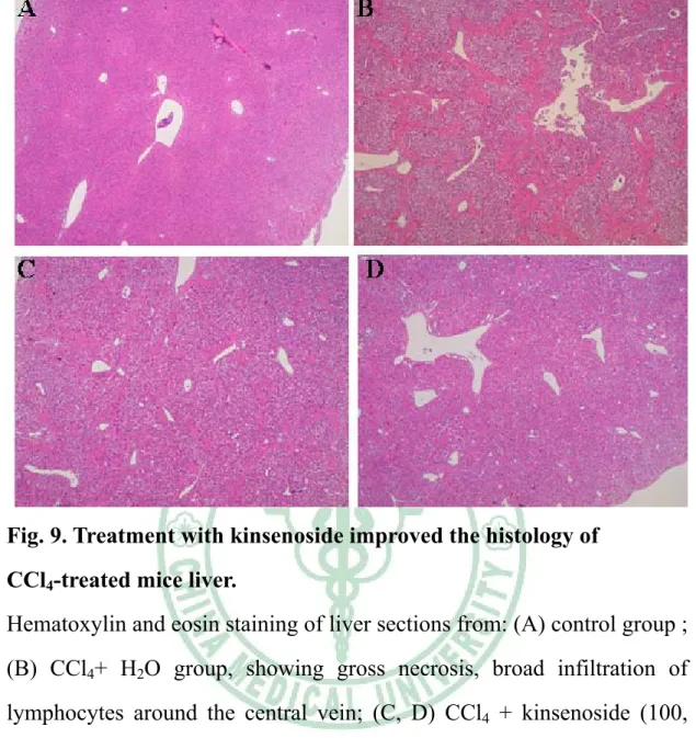 Fig. 9. Treatment with kinsenoside improved the histology of  CCl 4 -treated mice liver