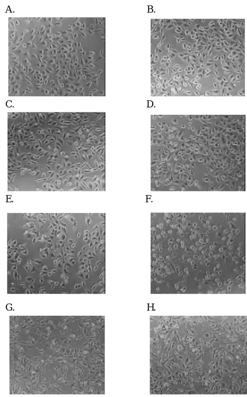 Figure 9.  The morphology of human stomach cancer (SC-M1) cells  after exposure to the  different doses of apigenin for 18 hr then were examined and photographed by phase  microscope (200x)