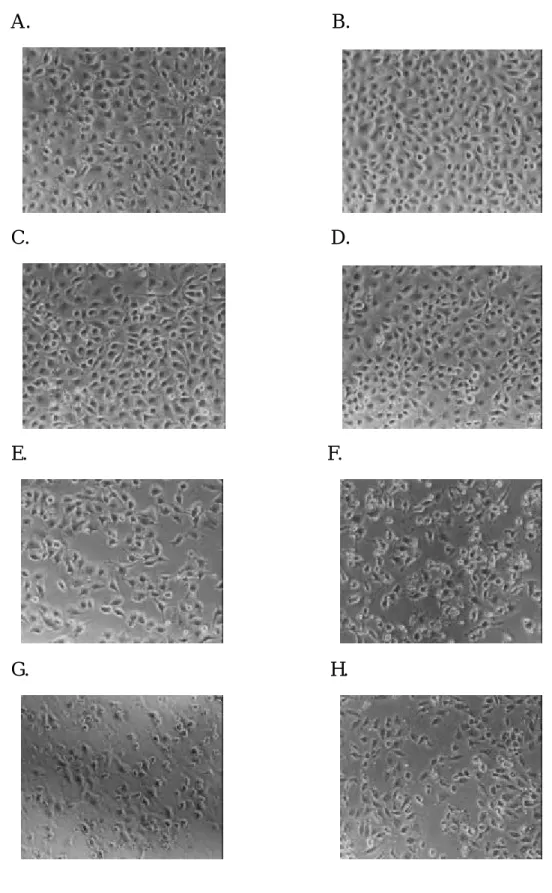 Figure 12.  The morphology of human stomach cancer (SC-M1) cells after exposure to the  different doses of apigenin for 48 hr then were examined and photographed by phase  microscope (200x)