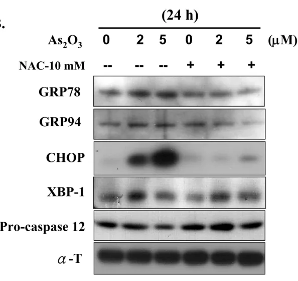 Figure 6 CHOP α-TAs2O3 0       2    5     0      2      5    (μM)NAC-10 mM---- --+      +      +(24 h)Pro-caspase 12GRP78GRP94XBP-1B.