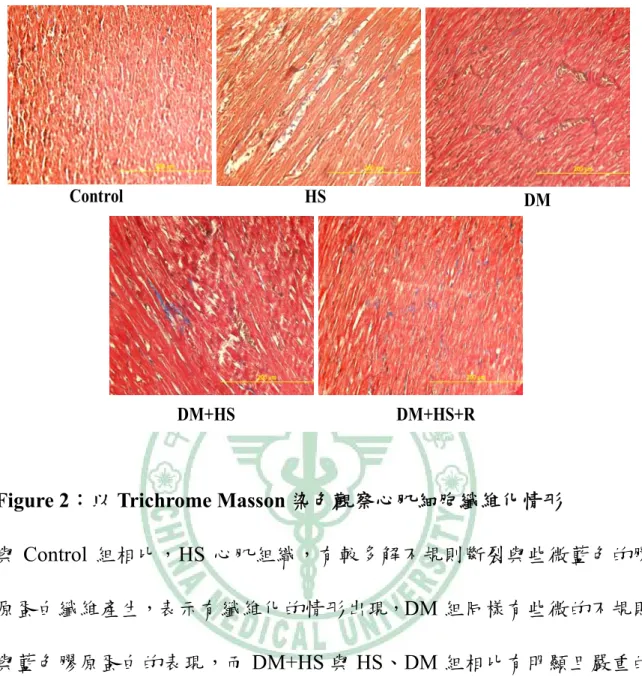 Figure 2：以 Trichrome Masson 染色觀察心肌細胞纖維化情形 