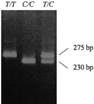 Figure 5 PCR-based restriction analysis of the LUM 1544 (T/C) polymorphism. The polymorphic region was amplified by PCR, resulting in an un-digestible fragment in lane 1 (275 bp), a digestible fragment in lane 2 (230 bp) and a heterozygote in lane 3.