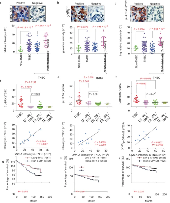 Figure 6   The   LINK-A-dependent   normoxic   HIF1α   signalling   pathway correlates with TNBC