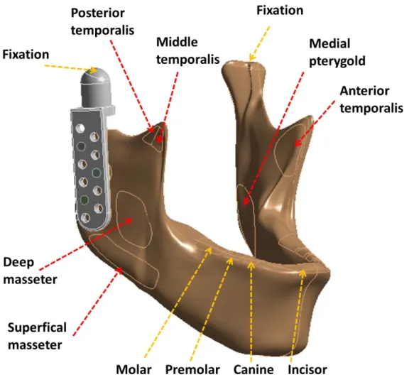 Fig. 2. Muscular force (red arrow) and constraints (yellow arrow) applied in the finite element simulation.