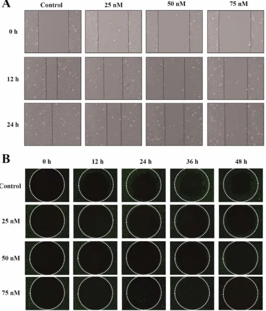Fig. 2. Bufalin affected the motility and migration of U-2 OS cells. Cells were exposed to 0, 25, 50, and 75 nM of bufalin for various periods of time (12, 24, 36, or 48 h)