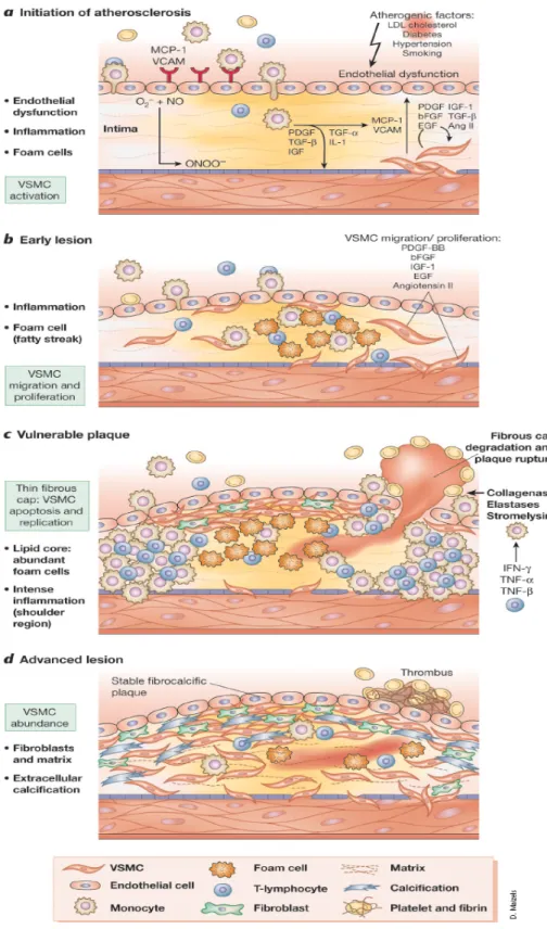 Fig. 2. The function of VSMCs during different stages of atherosclerosis. (Dzau et al,  2002) 