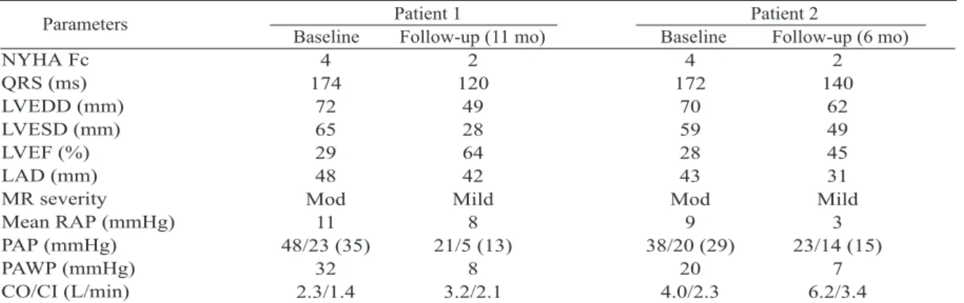 Fig. 2. Stored algorithm recordings from the pacemaker show freedom of atrial fibrillation in patient 1 (panel A) and a decrease in atrial fibrillation frequency and duration in patient 2 (panel B)