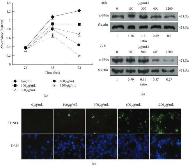 Figure 1: The mYGJ exhibits potent antifibrosis activity on HSC-T6 cells. (a) HSC-T6 cells were seeded onto 96-well plates and the indicated dose of mYGJ was added to the medium for 24, 48, and 72 hours, respectively
