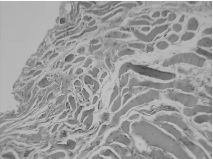 Figure 4-4. Effect of IL1-Ra on the muscle after myositis induction in pathology  finding 12 week after phobal ester injection