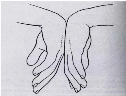 Figure 2-3 Phalen’s test 