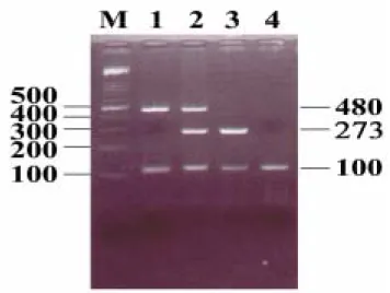 Fig. 1. The results of representative PCR analysis of GSTM1 and GSTT1 genes are shown