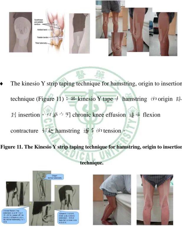 Figure 10. Clinical therapeutic applications of the Kinesio taping method for  knee OA