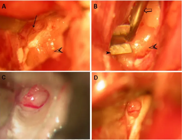 Figure 2.3 Application of laser probe for measurement of cochlear blood flow. A. 