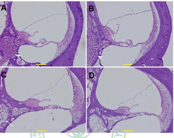 Figure 3.5 Hematoxylin/eosin-stained cochlear sections. A. Normal cochlear section. B