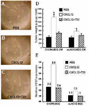 Figure 1. CXCR4 expression enhances BCC angiogenesis in vitro.