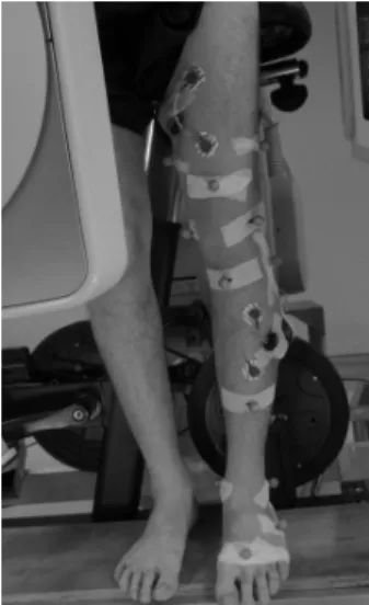 Fig. 1: Markers attached on left thigh, left shank,  and left foot. 