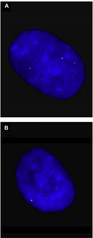 Fig. 2. Representative electrophoretograms of quantitative fluorescent poly- poly-merase chain reaction assays