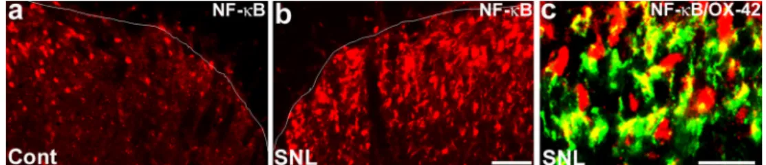 Figure 5. (a–c). Spinal nerve ligation (SNL) increases NF-κB expression in spinal microglia (a, b) SNL increases the immunoreactivity of NF-κB (65kD unit) on day 3 in the medial superficial spinal cord, compared to non-injured control (Cont) spinal cord