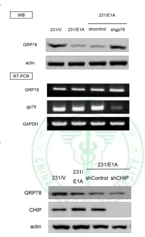 Figure  7.  Expression of  GRP78 was  rescued by  knockdown of E3 ligase,  gp78 but  not CHIP in protein level